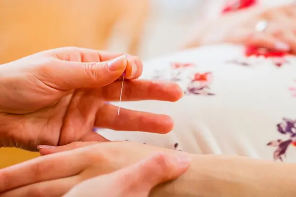 Hebamme wendet Akupunktur und Homöopathie an, um werdenden Müttern eine natürliche und medikamentenfreie Geburtserleichterung zu bieten.