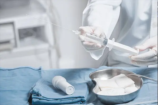 Ultraschallgeführte Chorionzottenbiopsie zur genetischen Untersuchung des Ungeborenen im frühen Schwangerschaftsstadium.