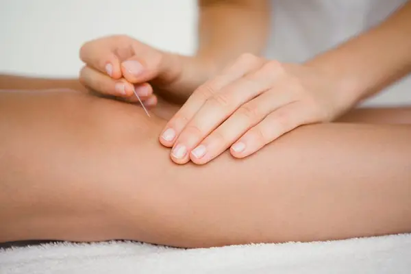 Hebamme führt Akupunktur bei einer schwangeren Frau durch, um die Geburt vorzubereiten und zu erleichtern.
